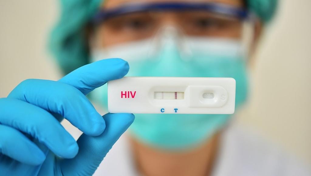 Saúde de Mato Grosso alerta sobre importância da testagem rápida contra o HIV