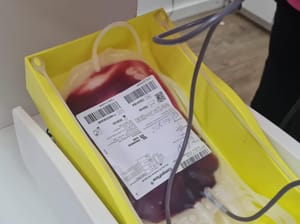 MT Hemocentro atende mais de 500 pacientes com a doença falciforme