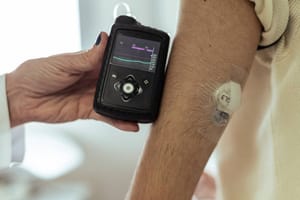 Justiça determina que plano de saúde forneça bomba de insulina para criança em Mato Grosso