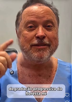 Blairo compara sua calvice com “degradação progressiva do meio ambiente”